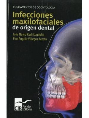 Infecciones Maxilofaciales De Origen Dental