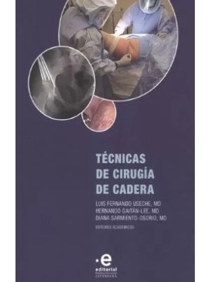 Tecnicas De Cirugia De Cadera