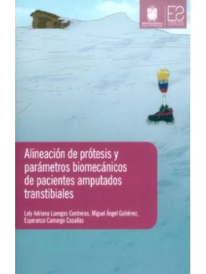 Alineacion De Protesis Y Parametros Biomecanicos