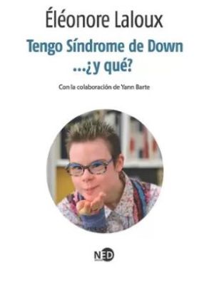 Tengo Sindrome De Down Y Que