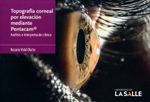 Topografía corneal por elevación mediante Pentacam