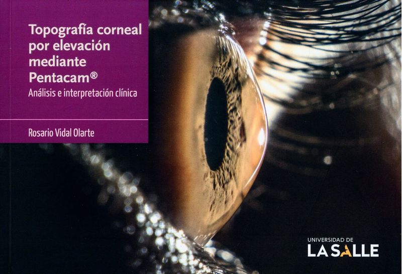 Topografía corneal por elevación mediante Pentacam